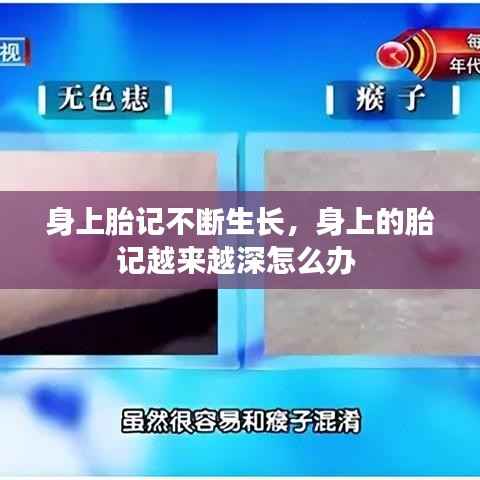 身上胎记不断生长,身上的胎记越来越深怎么办